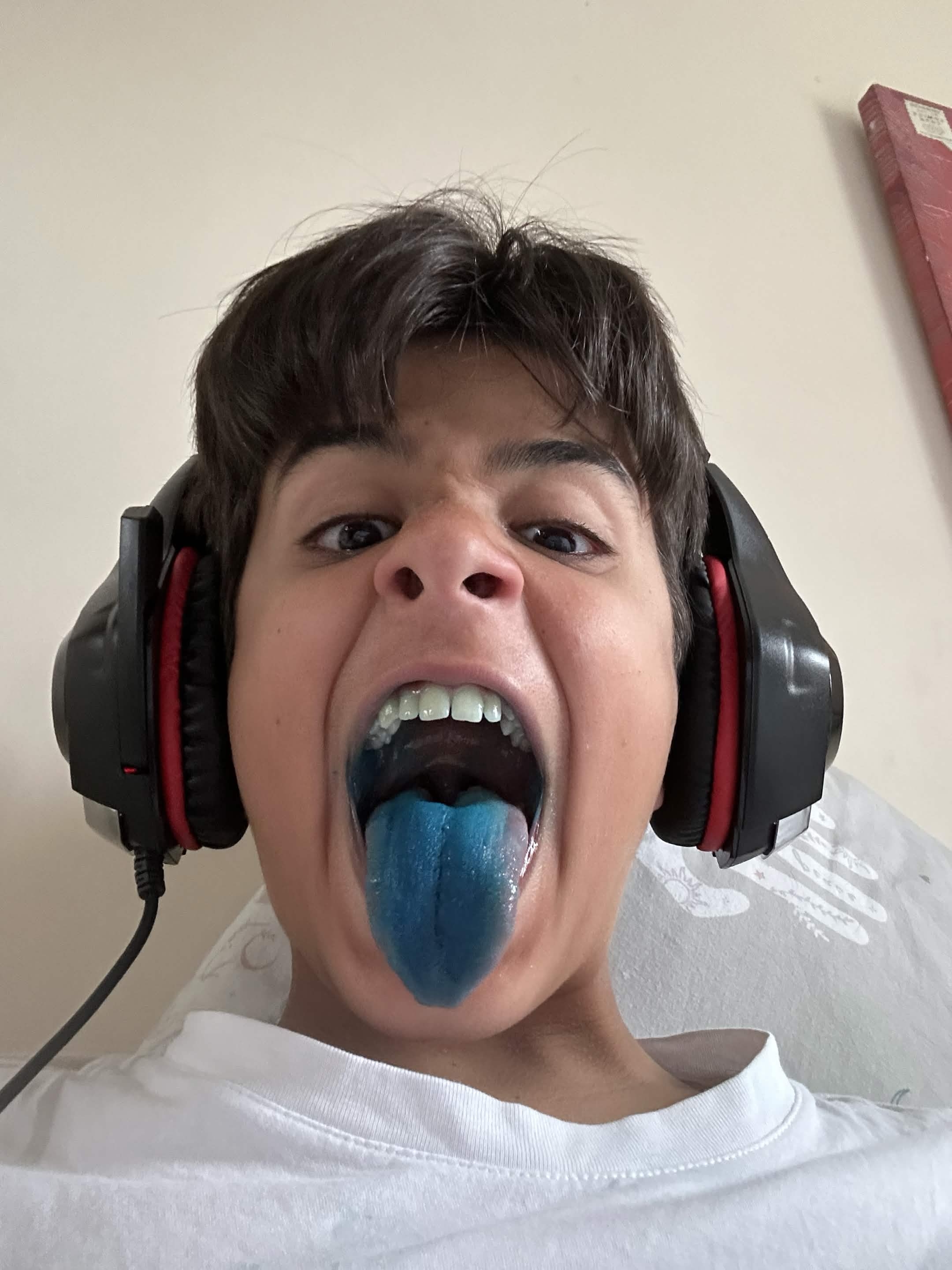 Tongue
